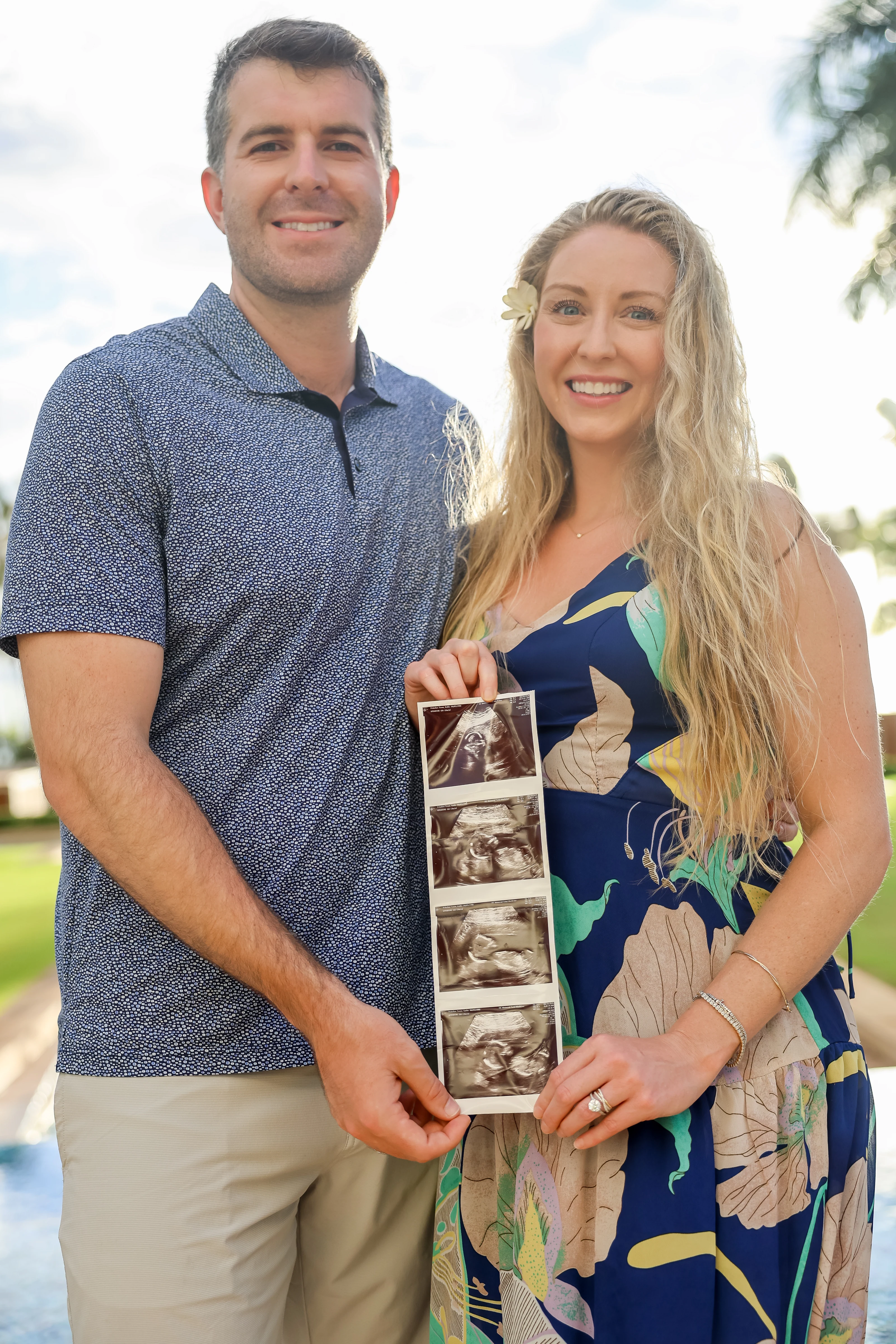 Expectant couple holding ultrasound photographs beneath palm trees
